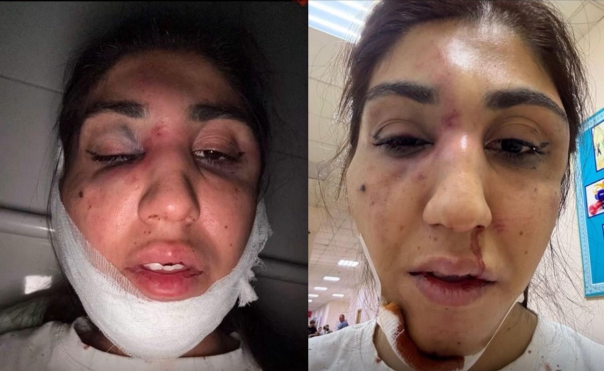 Алматы полициясы әйелді аяусыз соққыға жығу фактісі бойынша қылмыстық іс қозғады