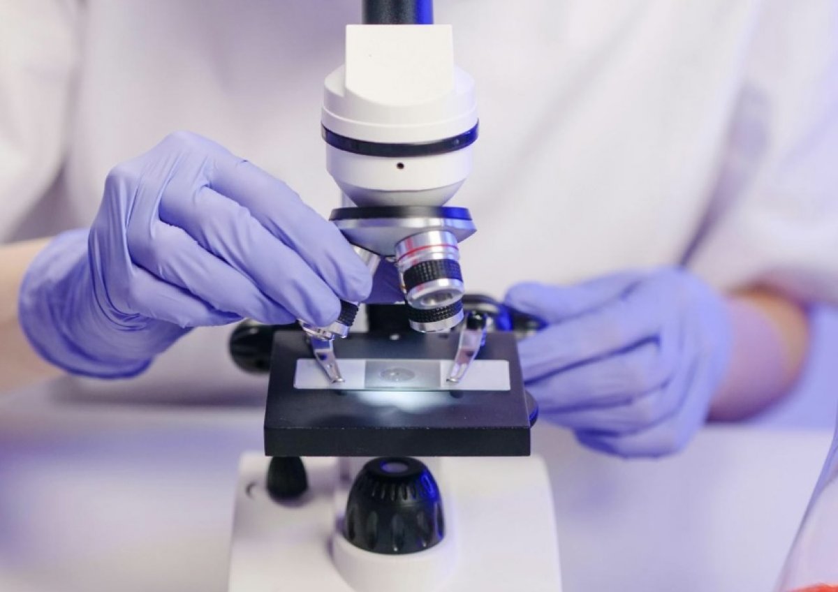 Сібір жарасынан қауіп бар ма - Алматы облысы әкімдігінде түсінік берді