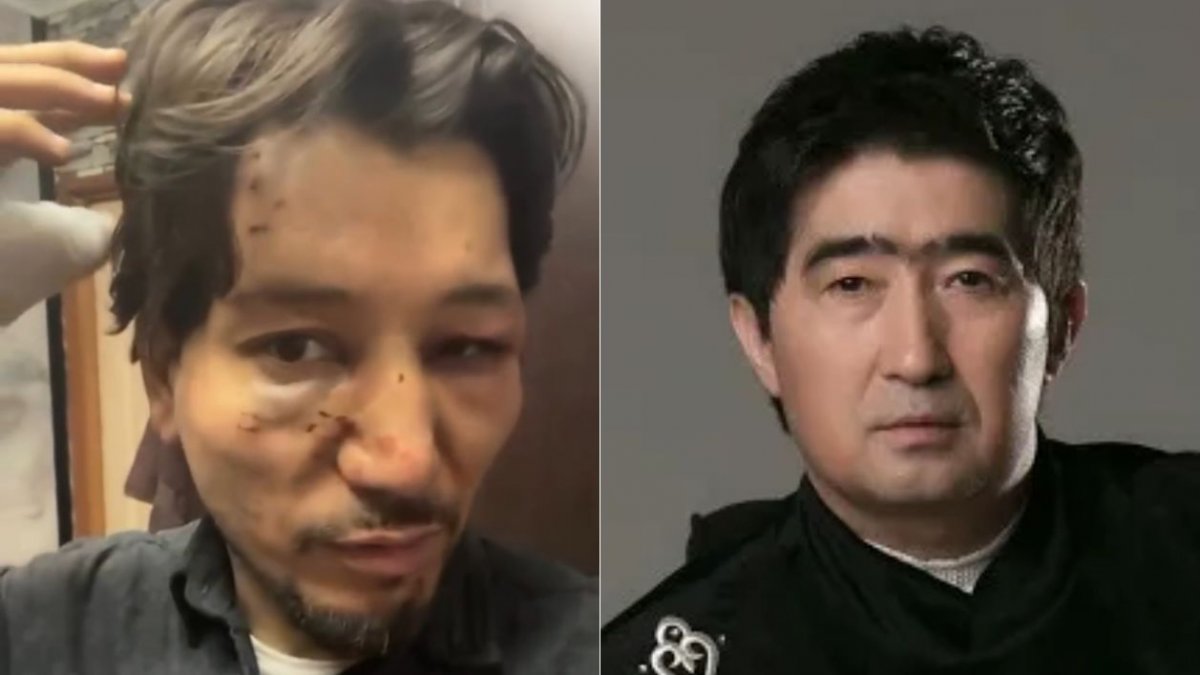 «Нұрмұқасан» тобының жаңа орындаушысы өзін Мұқасан Шахзадаев соққыға жыққанын айтты