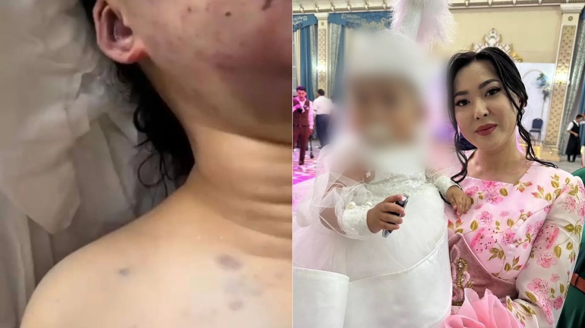 «Аузынан, құлағынан қан ағып тұрды»: куәгерлер Айзат Жұманованың өліміне қатысты шындықты айтты