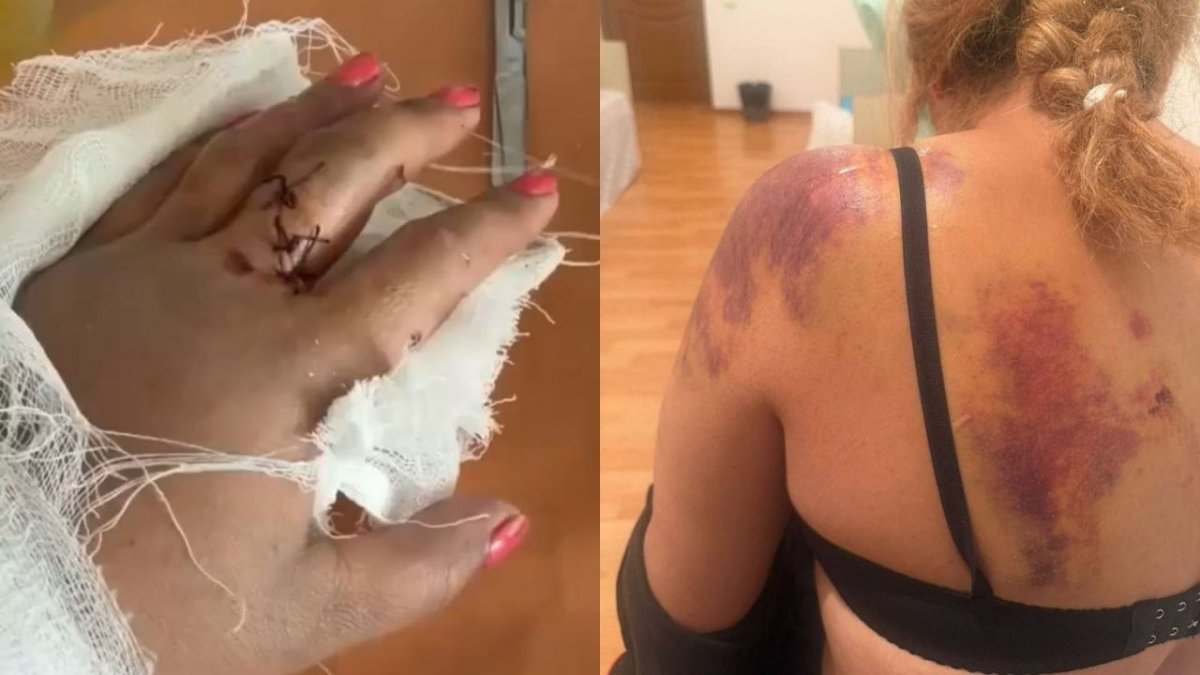 Жетісу облысы Ақсу ауданында ер адам әйелді күрекпен ұрып-соқты