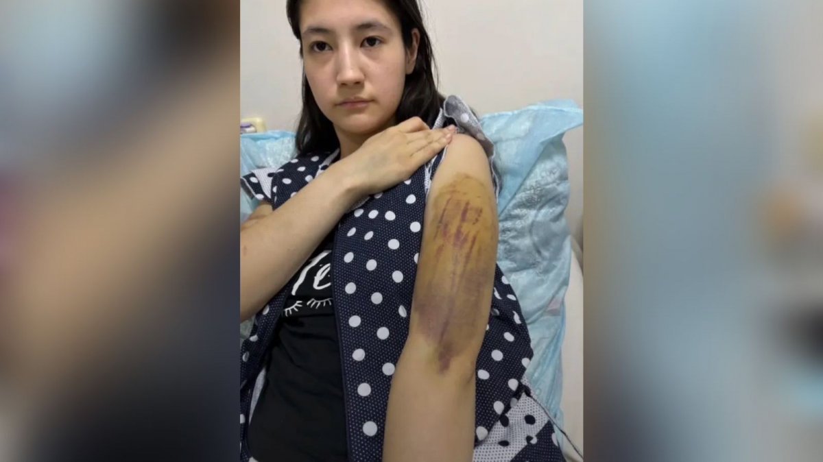 Қарағандыда ер адам 18 жастағы әйелін ұрып-соғып, көкбауырын түсіріп, баласын тартып алды