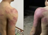 Атырауда жасөспірімді жабылып аяусыз соққыға жыққандар ұсталды