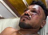 «Өлгендердің арасында есімді жидым»: Air India ұшағы апатында жалғыз жолаушы тірі қалды