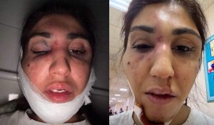Алматы полициясы әйелді аяусыз соққыға жығу фактісі бойынша қылмыстық іс қозғады