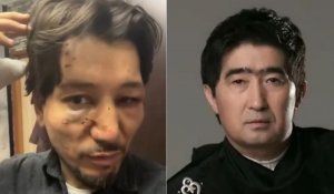 «Нұр-Мұқасан» тобының жаңа орындаушысы өзін Мұқасан Шахзадаев соққыға жыққанын айтты