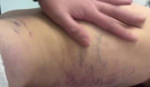 Әкесі аяусыз соққыға жыққан қыздың жағдайы белгілі болды