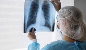 Еліміз туберкулезді емдеу тиімділігі бойынша жоғары нәтижеге ие