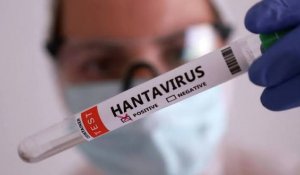 Хантавирус пандемияға ұласуы мүмкін бе: ДДСҰ мәлімдеме жасады