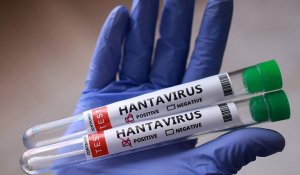 Қазақстанда хантавирус таралуы мүмкін бе: Мамандар жауап берді