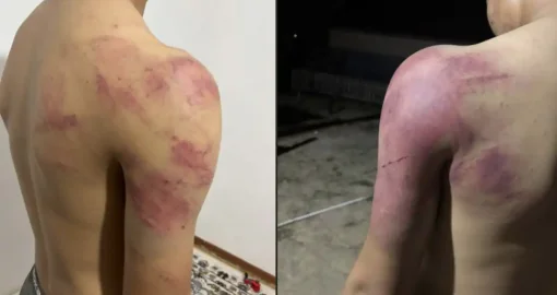 Атырауда жасөспірімді жабылып аяусыз соққыға жыққандар ұсталды
