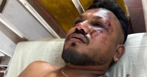 «Өлгендердің арасында есімді жидым»: Air India ұшағы апатында жалғыз жолаушы тірі қалды