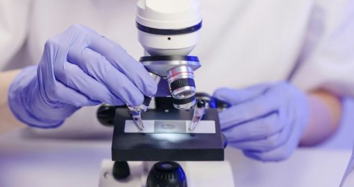 Сібір жарасынан қауіп бар ма - Алматы облысы әкімдігінде түсінік берді