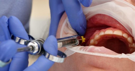 Астанада үш жасар қыз тісін емдеткеннен кейін қайтыс болды