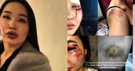 Атырауда блогерді ұрып, үйқамаққа қамалған күдіктінің ойын-сауық орнында жүргені анықталды