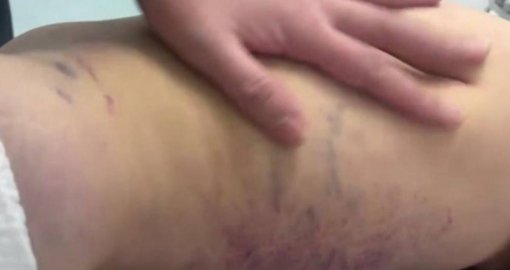 Әкесі аяусыз соққыға жыққан қыздың жағдайы белгілі болды