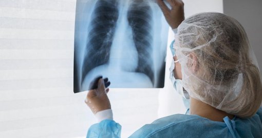 Еліміз туберкулезді емдеу тиімділігі бойынша жоғары нәтижеге ие