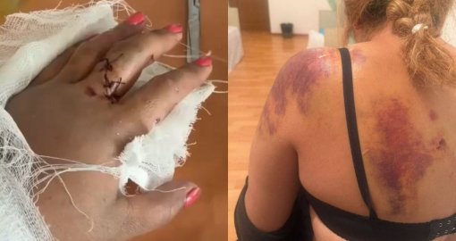 Жетісу облысы Ақсу ауданында ер адам әйелді күрекпен ұрып-соқты