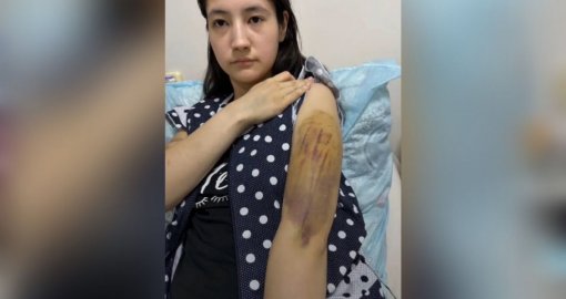 Қарағандыда ер адам 18 жастағы әйелін ұрып-соғып, көкбауырын түсіріп, баласын тартып алды