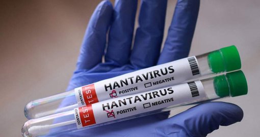 Қазақстанда хантавирус таралуы мүмкін бе: Мамандар жауап берді